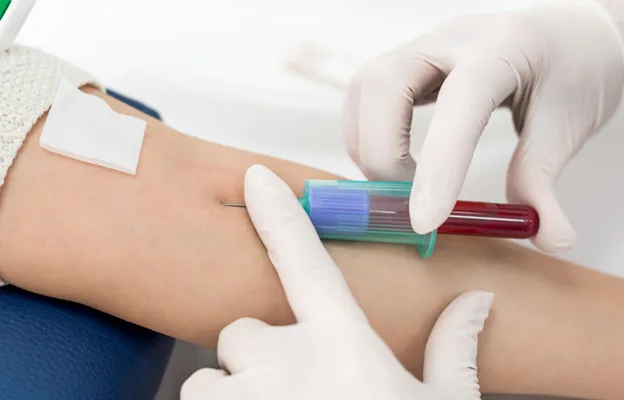 Hemofilia en Colombia: el 66% de pacientes severos ya sufre daño articular irreversible