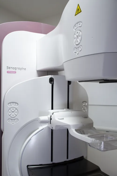 La mamografía con contraste y la biopsia al vacío transforman la detección temprana del cáncer de mama