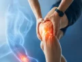 La salud de la rodilla marca la primera causa de dolor articular en Colombia