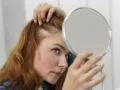 Recomendaciones prácticas para tratar la caída del cabello