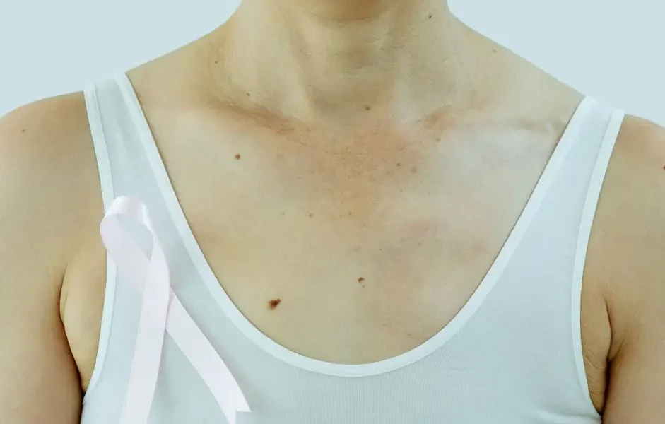 Cáncer de mama: prevenir y detectar a tiempo son la clave para reducir su impacto