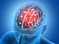 Ocho de cada diez accidentes cerebrovasculares se pueden prevenir