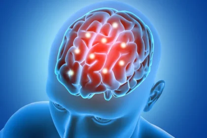 Ocho de cada diez accidentes cerebrovasculares se pueden prevenir